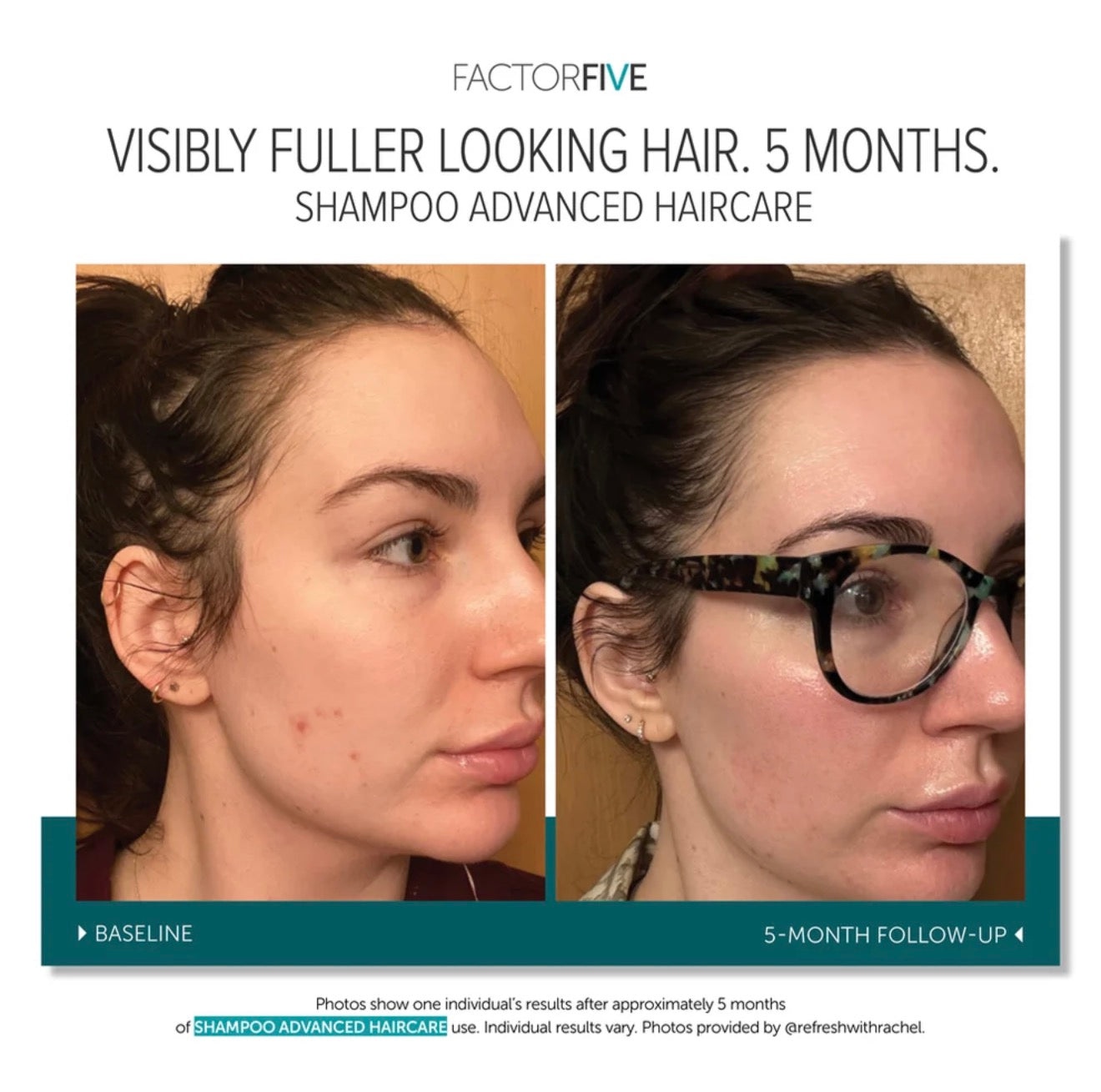 FACTORFIVE SHAMPOO ADVANCED HAIRCARE